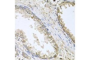 Immunohistochemistry of paraffin-embedded human prostate using CYP46A1 antibody at dilution of 1:100 (x40 lens).