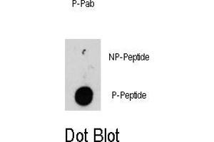 Image no. 1 for anti-Integrin-Linked Kinase (ILK) (pThr173) antibody (ABIN358419) (ILK anticorps  (pThr173))