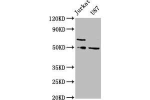 Western Blot Positive WB detected in: Jurkat whole cell lysate, U87 whole cell lysate All lanes: SH3BP5 antibody at 1:2000 Secondary Goat polyclonal to rabbit IgG at 1/50000 dilution Predicted band size: 51, 33 kDa Observed band size: 51 kDa