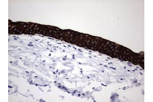 Immunohistochemistry (IHC) image for anti-Keratin Acidic (AE1) antibody (ABIN2715666)