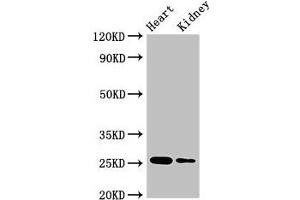 Western Blot Positive WB detected in: Mouse heart tissue, Mouse kidney tissue All lanes: CSH2 antibody at 4 μg/mL Secondary Goat polyclonal to rabbit IgG at 1/50000 dilution Predicted band size: 25, 19, 14 kDa Observed band size: 25 kDa (CSH1 anticorps  (AA 27-217))