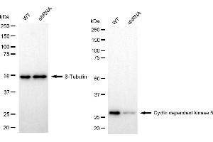 Western blotting analysis using cyclin dependent kinase 5 antibody (ABIN7798217). (Recombinant CDK5 anticorps)