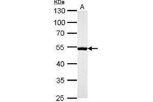 WB Image Desmin antibody detects DES protein by Western blot analysis.