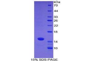 SDS-PAGE analysis of Mouse S100A7 Protein. (S100A7 Protéine)