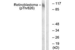 Western blot analysis of extracts from HepG2 cells treated with nocodazole 1ug/ml 16h, using Retinoblastoma (Phospho-Thr826) Antibody. (Retinoblastoma Protein (Rb) anticorps  (pThr826))