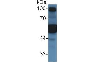 Detection of a1AT in Mouse Kidney lysate using Polyclonal Antibody to Alpha-1-Antitrypsin (a1AT) (SERPINA1 anticorps  (AA 25-413))