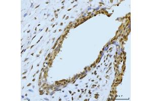 IHC analysis of SBNO1 using anti-SBNO1 antibody (ABIN7601710). (SBNO1 anticorps  (AA 43-1303))