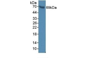Detection of BFP in Rat Serum using Polyclonal Antibody to Brain Finger Protein (BFP) (RNF112 anticorps  (AA 256-504))