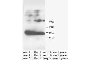 Image no. 2 for anti-Fatty Acid Binding Protein 1, Liver (FABP1) (N-Term) antibody (ABIN1495134) (FABP1 anticorps  (N-Term))