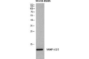 anti-Vamp-1+2+3 (Internal Region) antibody