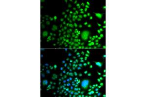 Immunofluorescence analysis of A549 cell using PAX6 antibody. (PAX6 anticorps)