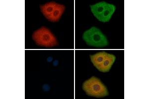ABIN6264912 and ABIN6269293 staining Hela cells by IF/ICC. (RPS6 anticorps  (C-Term))