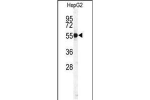 Western blot analysis of CTSH Antibody in HepG2 cell line lysates (35ug/lane) (Cathepsin H anticorps  (N-Term))