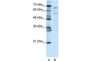 WB Suggested Anti-TAF6L Antibody Titration:  5. (TAF6L anticorps  (N-Term))