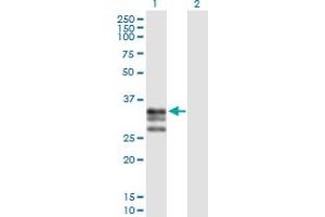 Western Blot analysis of ICAM4 expression in transfected 293T cell line by ICAM4 MaxPab polyclonal antibody. (ICAM4 anticorps  (AA 1-272))