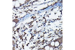 Immunohistochemistry of paraffin-embedded human colon using G Rabbit pAb (ABIN6129931, ABIN6137010, ABIN6137011 and ABIN6217659) at dilution of 1:100 (40x lens).