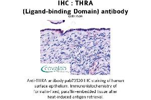 Image no. 1 for anti-Thyroid Hormone Receptor, alpha (THRA) antibody (ABIN1740044) (THRA anticorps)