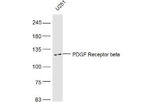 U251 lysates probed with PDGF Receptor beta Polyclonal Antibody, Unconjugated  at 1:500 dilution and 4˚C overnight incubation. (PDGFRB anticorps  (AA 981-1066))