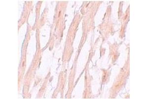 Immunohistochemistry of ATG9A in human heart tissue with ATG9A antibody at 5 μg/mL.