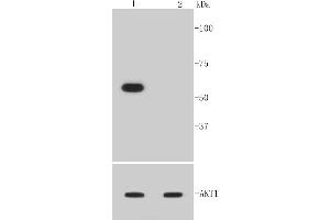 Lane 1: NIH/3T3 treated with PDGF, Lane 2: NIH/3T3 untreatedlysates probed with Akt1(Ser473) (12A1) Monoclonal Antibody  at 1:1000 overnight at 4˚C. (AKT1 anticorps  (pSer473))