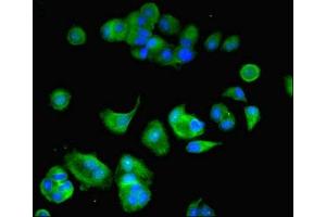Immunofluorescent analysis of MCF-7 cells using ABIN7175258 at dilution of 1:100 and Alexa Fluor 488-congugated AffiniPure Goat Anti-Rabbit IgG(H+L)