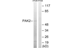 Western Blotting (WB) image for anti-P21-Activated Kinase 2 (PAK2) (Ser62) antibody (ABIN1848253) (PAK2 anticorps  (Ser62))