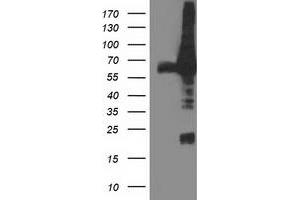 Western Blotting (WB) image for anti-Dipeptidyl-Peptidase 3 (DPP3) antibody (ABIN1497831) (DPP3 anticorps)