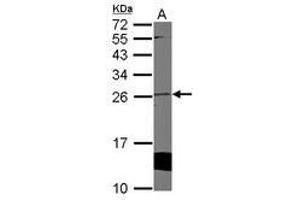 Image no. 1 for anti-Cytoglobin (CYGB) (AA 1-190) antibody (ABIN1501883) (CYGB anticorps  (AA 1-190))