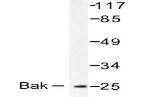 Image no. 1 for anti-BCL2-Antagonist/killer 1 (BAK1) antibody (ABIN265324) (BAK1 anticorps)