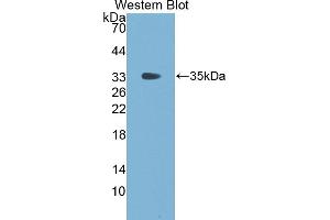 Detection of Recombinant FGg, Cattle using Polyclonal Antibody to Fibrinogen Gamma (FGg)