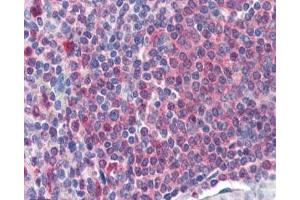 IHC staining of FFPE human spleen with Catalase antibody at 2ug/ml. (Catalase anticorps)