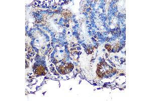 Immunohistochemistry of paraffin-embedded mouse intestin using ITLN1 Rabbit pAb (ABIN6132446, ABIN6142601, ABIN6142602 and ABIN6223070) at dilution of 1:100 (40x lens). (ITLN1/Omentin anticorps  (AA 19-313))