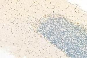 Immunohistochemistry analysis of paraffin-embedded rat cerebellum using,RPAP2 (ABIN7075481) at dilution of 1: 1000
