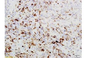 Formalin-fixed and paraffin embedded mouse lung labeled with Rabbit Anti PRAME Polyclonal Antibody, Unconjugated  at 1:200 followed by conjugation to the secondary antibody and DAB staining (PRAME anticorps  (AA 151-250))