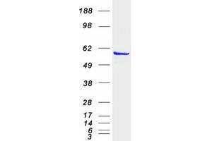 Inosine 5'-Phosphate Dehydrogenase 1 (IMPDH1) (Transcript Variant 1) protein (Myc-DYKDDDDK Tag)