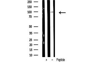 Western blot analysis of ADAM 17 expression in H whole cell lysates.