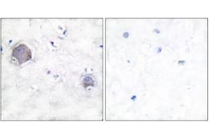 Immunohistochemical analysis of paraffin-embedded human brain tissue, using Notch 1 (cleaved-Val1744) antibody. (Notch1 anticorps  (Cleaved-Val1754, Internal Region))