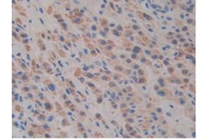 IHC-P analysis of Mouse Liver Tissue, with DAB staining. (SLIT1 anticorps  (AA 603-773))