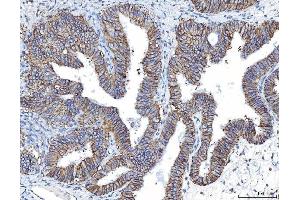 IHC analysis of Poliovirus Receptor/PVR using anti-Poliovirus Receptor/PVR antibody (ABIN7601071). (Poliovirus Receptor anticorps  (AA 28-331))