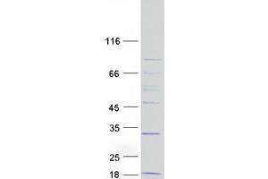 Validation with Western Blot