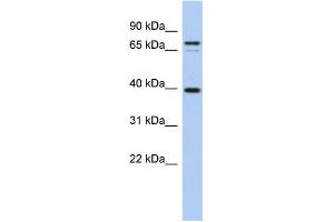 WB Suggested Anti-NYD-SP21 Antibody Titration:  0. (MS4A14 anticorps  (Middle Region))