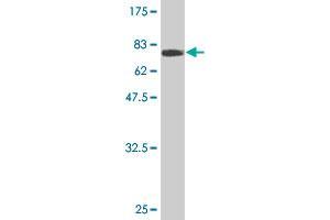Western Blot detection against Immunogen (69. (ZFYVE19 anticorps  (AA 1-396))