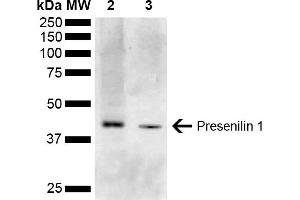 Western blot analysis of Mouse Kidney, Liver showing detection of ~52. (Presenilin 1 anticorps  (AA 1-100) (HRP))