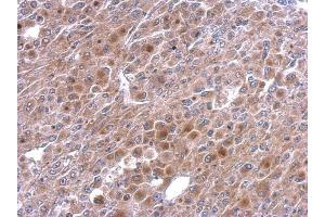 IHC-P Image TNFalpha-IP 2 antibody [C1C3] detects TNFalpha-IP 2 protein at cytosol on HeLa xenograft by immunohistochemical analysis.