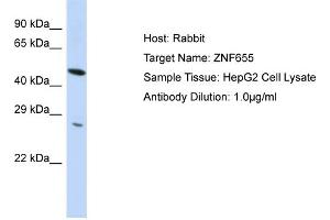 Host:  Rabbit  Target Name:  ZNF655  Sample Type:  HepG2 Whole Cell lysates  Antibody Dilution:  1. (ZNF655 anticorps  (N-Term))