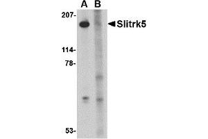 Western Blotting (WB) image for anti-SLIT and NTRK-Like Family, Member 5 (SLITRK5) (Middle Region 2) antibody (ABIN1031202) (SLITRK5 anticorps  (Middle Region 2))