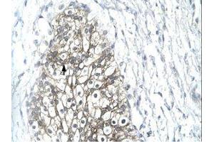 Image no. 1 for anti-Matrix Metallopeptidase 19 (MMP19) (AA 349-398) antibody (ABIN202685)