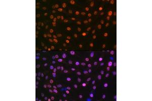 Immunofluorescence analysis of C6 cells using MB/MB/ML2 Rabbit mAb (ABIN1679325, ABIN3019109, ABIN3019110 and ABIN7101716) at dilution of 1:100 (40x lens).