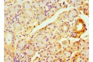 Immunohistochemistry of paraffin-embedded human pancreatic tissue using ABIN7144328 at dilution of 1:100 (TAP1 anticorps  (AA 524-808))