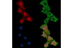 DHX32 Antibody staining HepG2 cells by IF/ICC. (DHX32 anticorps)